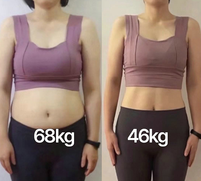 당뇨, 고혈압 환자 Before & After